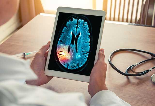 Doctor holding a tablet with a brain scan